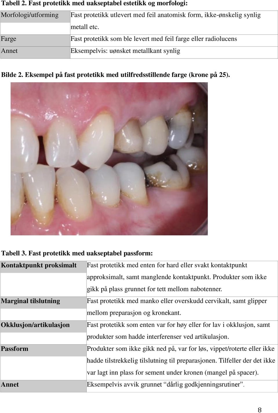 Tabell 3. Fast protetikk med uakseptabel passform: Kontaktpunkt proksimalt Fast protetikk med enten for hard eller svakt kontaktpunkt approksimalt, samt manglende kontaktpunkt.