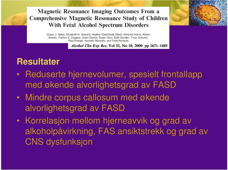 økende alvorlighetsgrad av FASD Korrelasjon mellom hjerneavvik