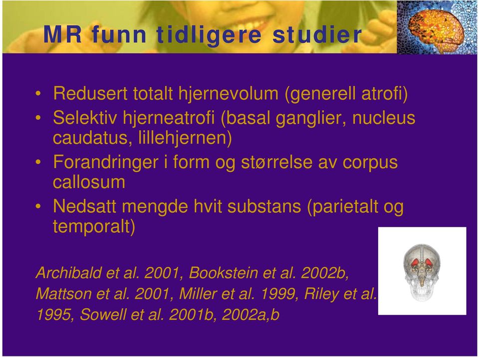 callosum Nedsatt mengde hvit substans (parietalt og temporalt) Archibald et al.