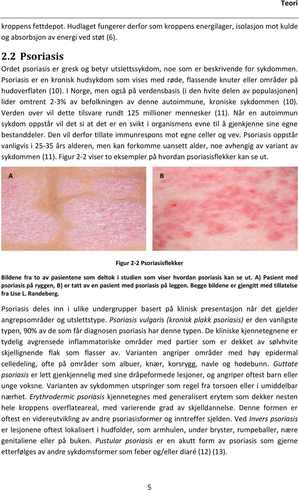 Psoriasis er en kronisk hudsykdom som vises med røde, flassende knuter eller områder på hudoverflaten (10).