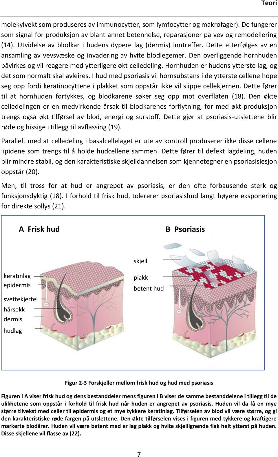 Den overliggende hornhuden påvirkes og vil reagere med ytterligere økt celledeling. Hornhuden er hudens ytterste lag, og det som normalt skal avleires.