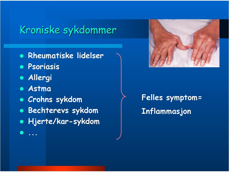 Crohns sykdom Bechterevs sykdom