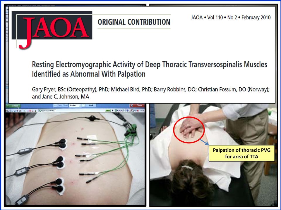 thoracic