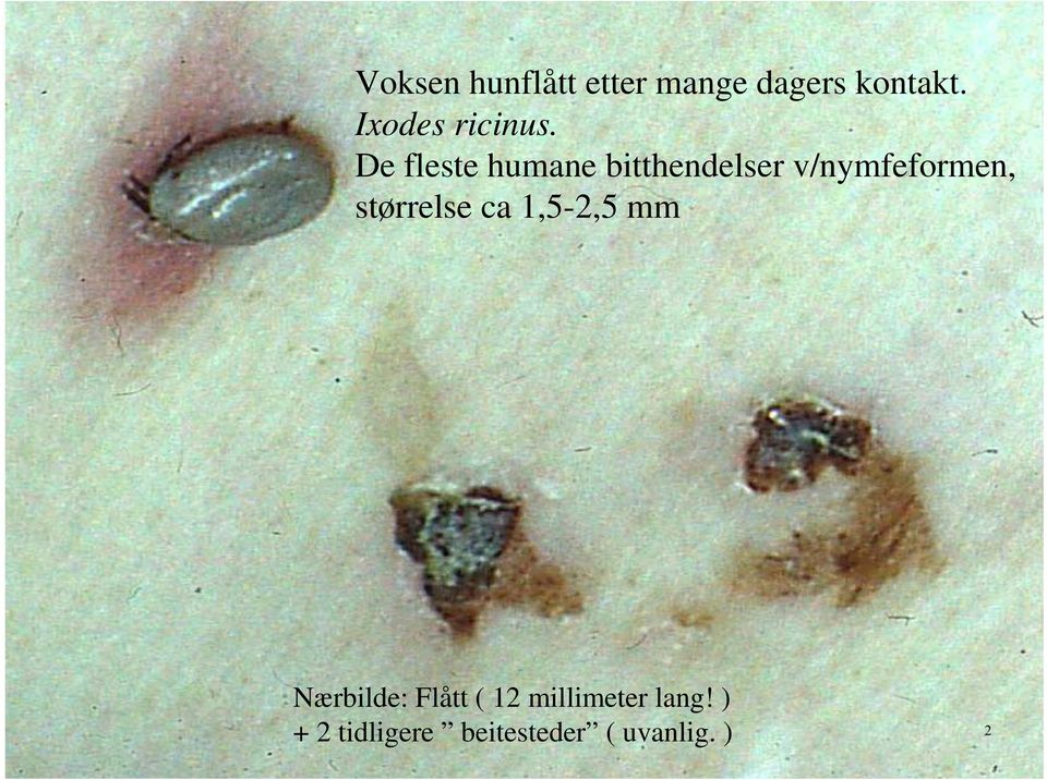 De De fleste fleste humane humane bitthendelser bitthendelser v/nymfeformen, v/nymfeformen, størrelse