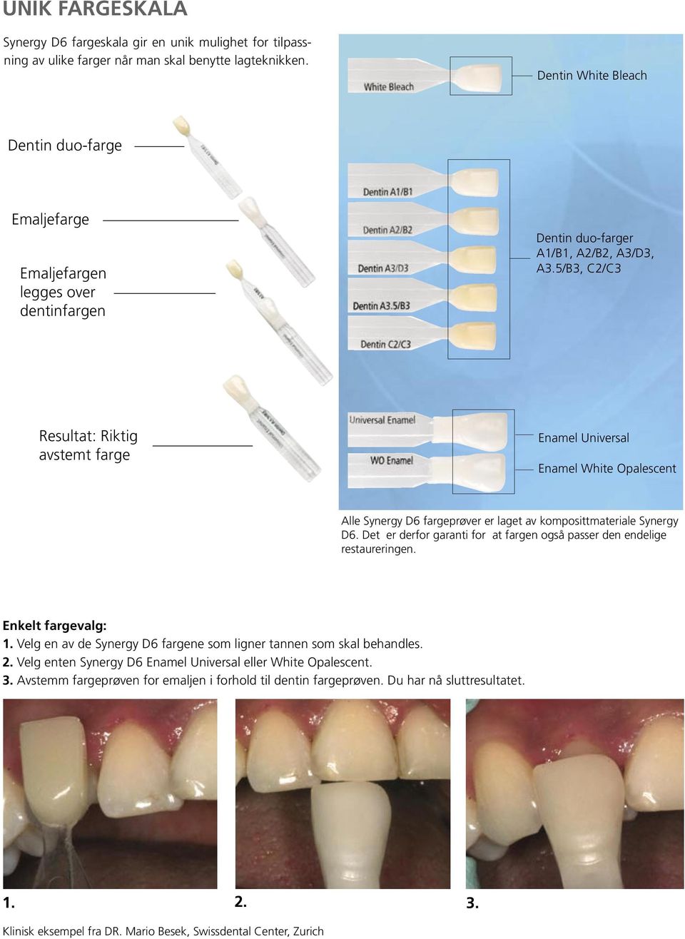 5/B3, C2/C3 Resultat: Riktig avstemt farge Enamel Universal Enamel White Opalescent Alle Synergy D6 fargeprøver er laget av komposittmateriale Synergy D6.