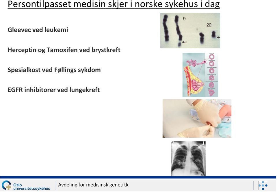 brystkreft Spesialkost ved Føllings sykdom EGFR