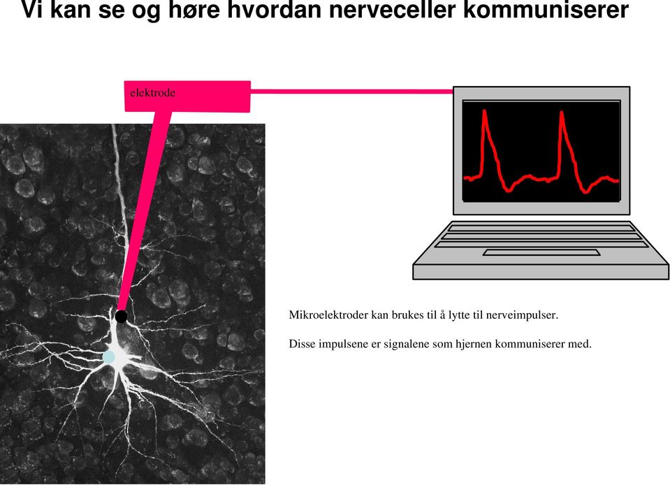 brukes til å lytte til nerveimpulser.