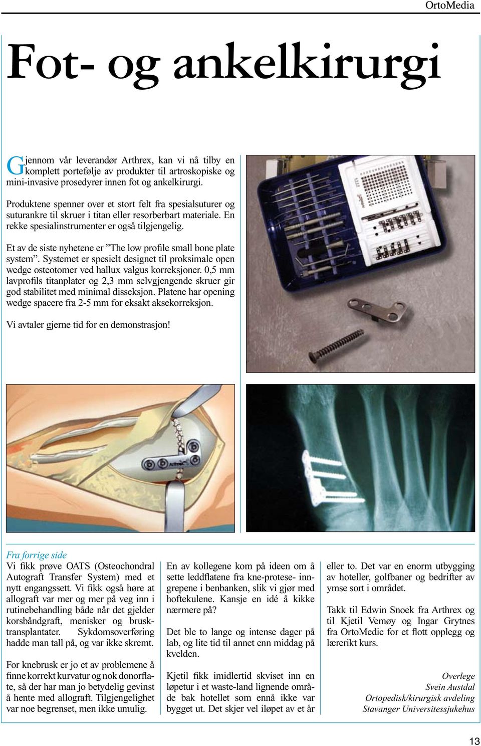 Et av de siste nyhetene er The low profile small bone plate system. Systemet er spesielt designet til proksimale open wedge osteotomer ved hallux valgus korreksjoner.