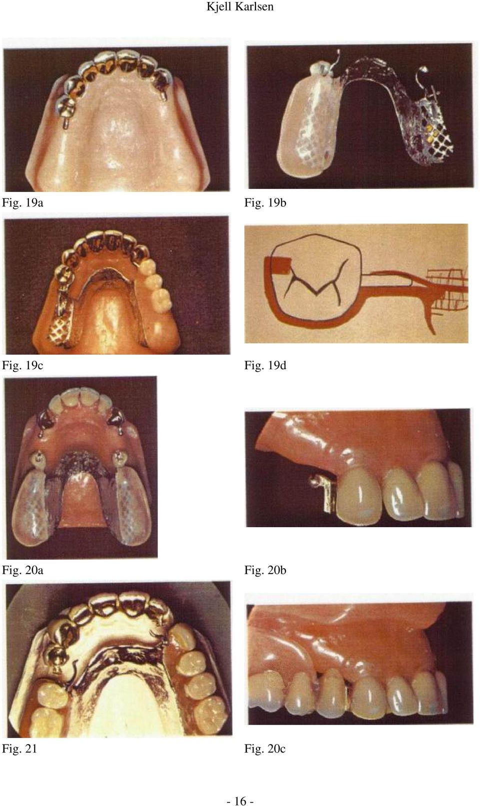 19d Fig. 20a Fig.