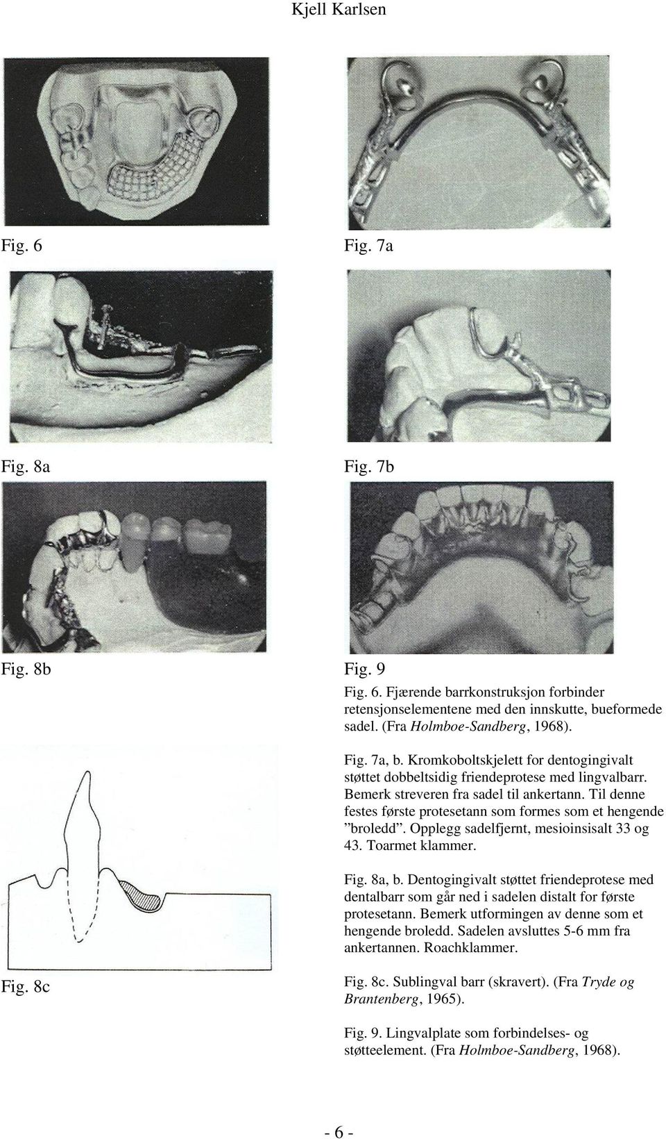 Til denne festes første protesetann som formes som et hengende broledd. Opplegg sadelfjernt, mesioinsisalt 33 og 43. Toarmet klammer. Fig. 8a, b.