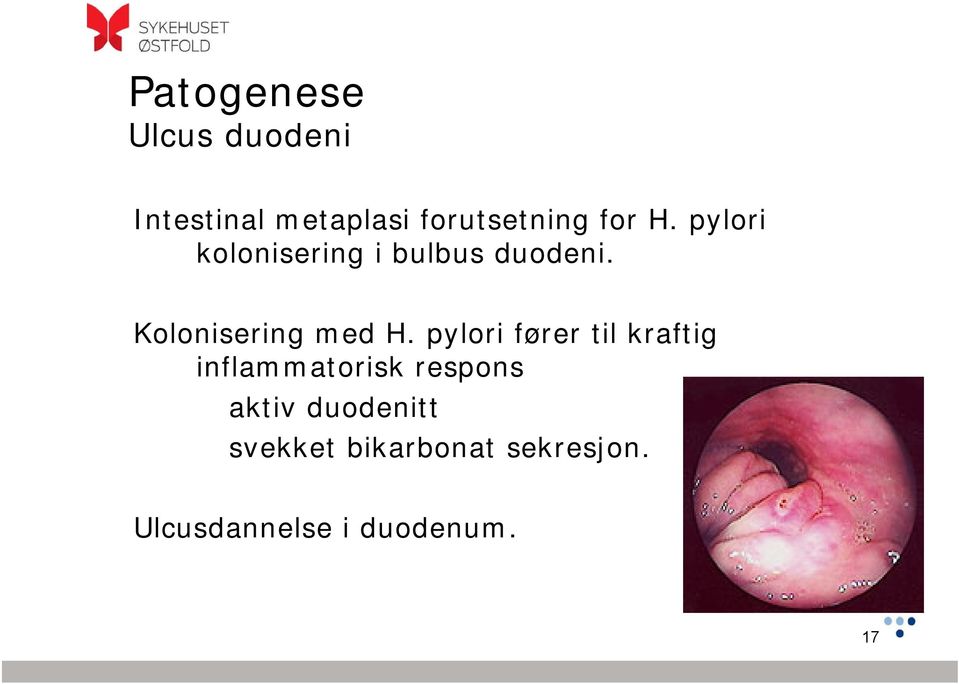 Kolonisering med H.