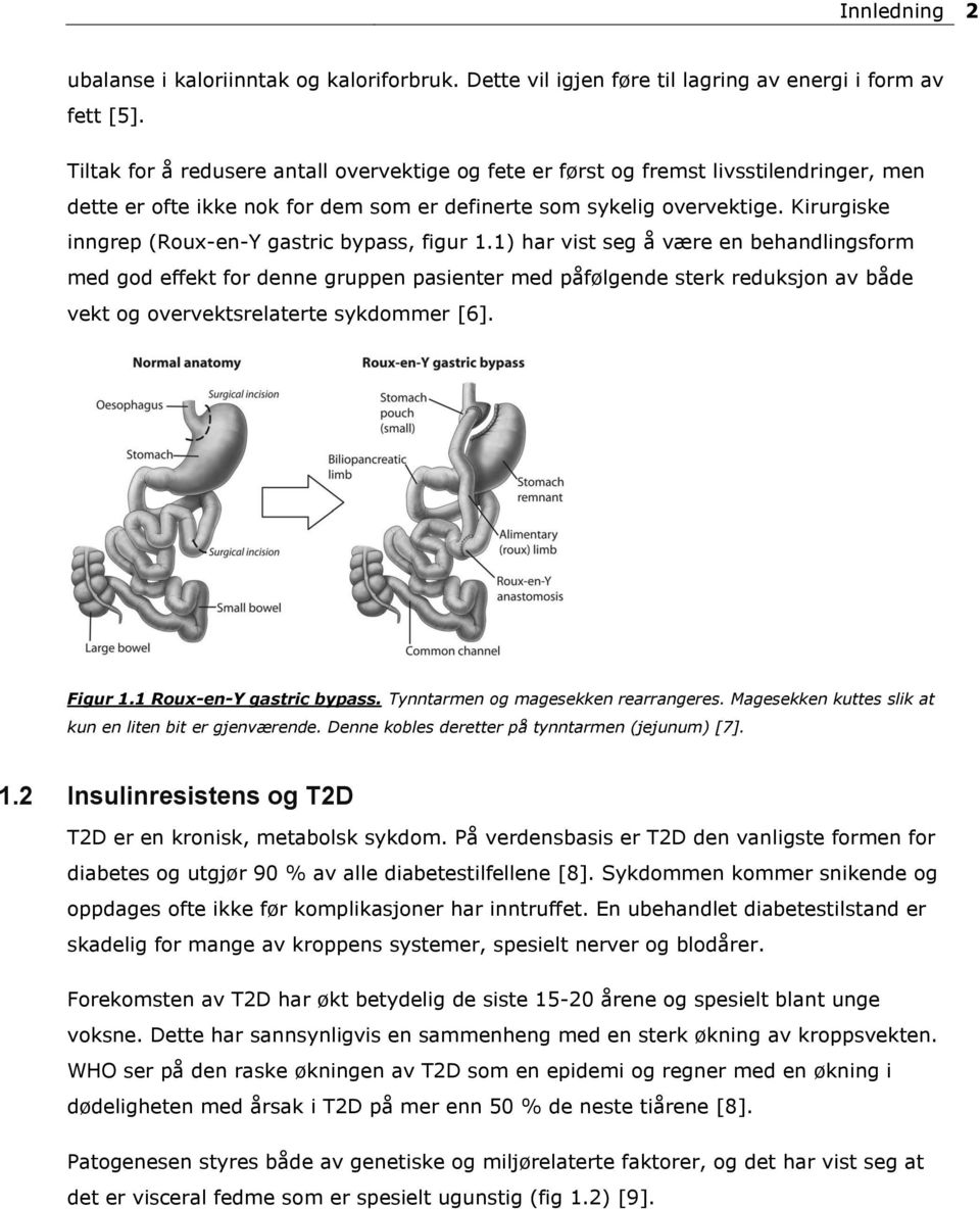 Kirurgiske inngrep (Roux-en-Y gastric bypass, figur 1.