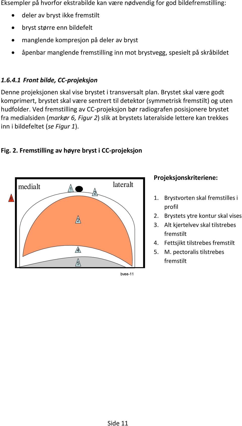 Brystet skal være godt komprimert, brystet skal være sentrert til detektor (symmetrisk fremstilt) og uten hudfolder.