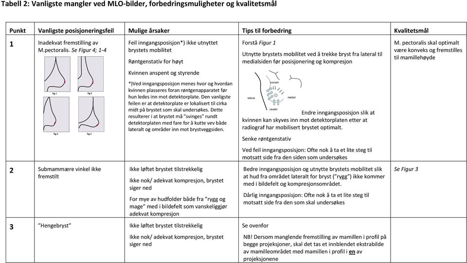 Se Figur 4; 1-4 fig 1 fig 3 2 Submammære vinkel ikke fremstilt fig 2 fig 4 Feil inngangsposisjon*) ikke utnyttet brystets mobilitet Røntgenstativ for høyt Kvinnen anspent og styrende *)Ved