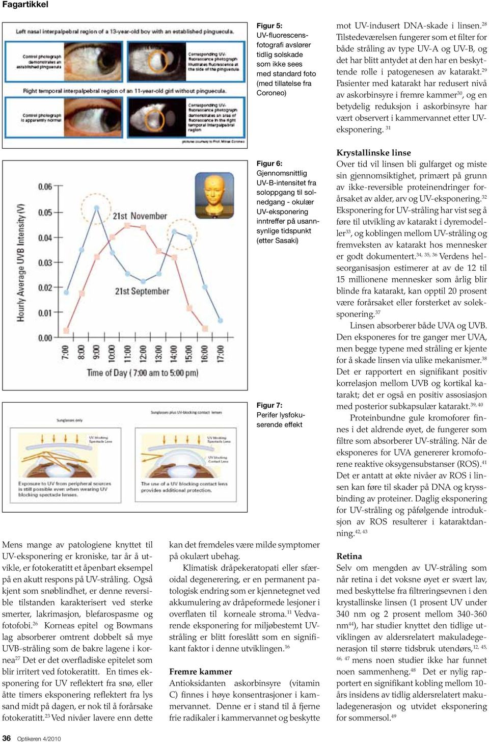 29 Pasienter med katarakt har redusert nivå av askorbinsyre i fremre kammer 30, og en betydelig reduksjon i askorbinsyre har vært observert i kammervannet etter UVeksponering.