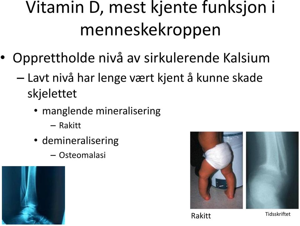 lenge vært kjent å kunne skade skjelettet manglende