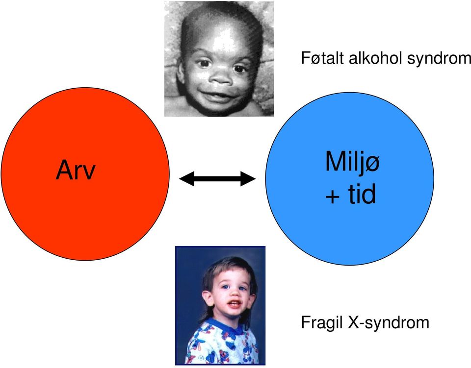 syndrom Arv