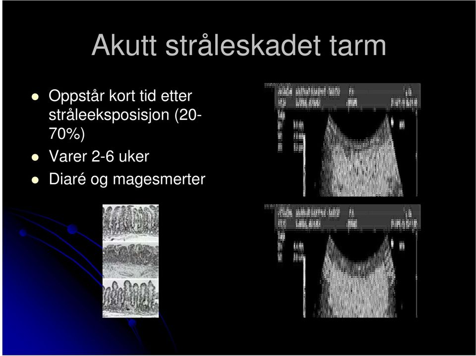 stråleeksposisjon (20-70%)