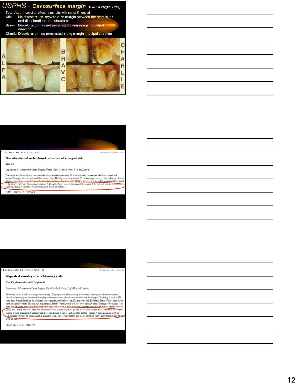 discoloration tooth structure Bravo Discoloration has not penetrated along margin in pulpal