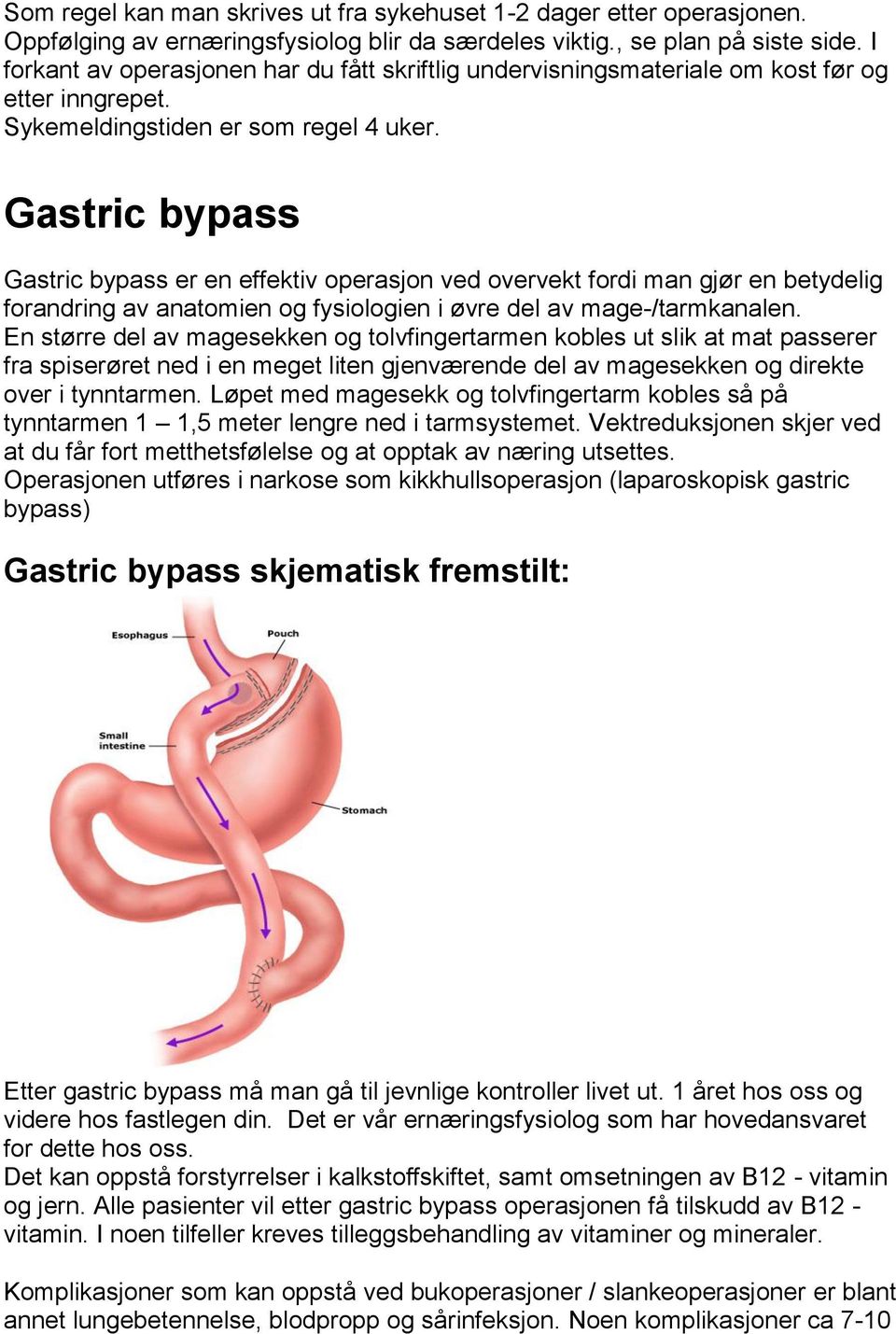 Gastric bypass Gastric bypass er en effektiv operasjon ved overvekt fordi man gjør en betydelig forandring av anatomien og fysiologien i øvre del av mage-/tarmkanalen.