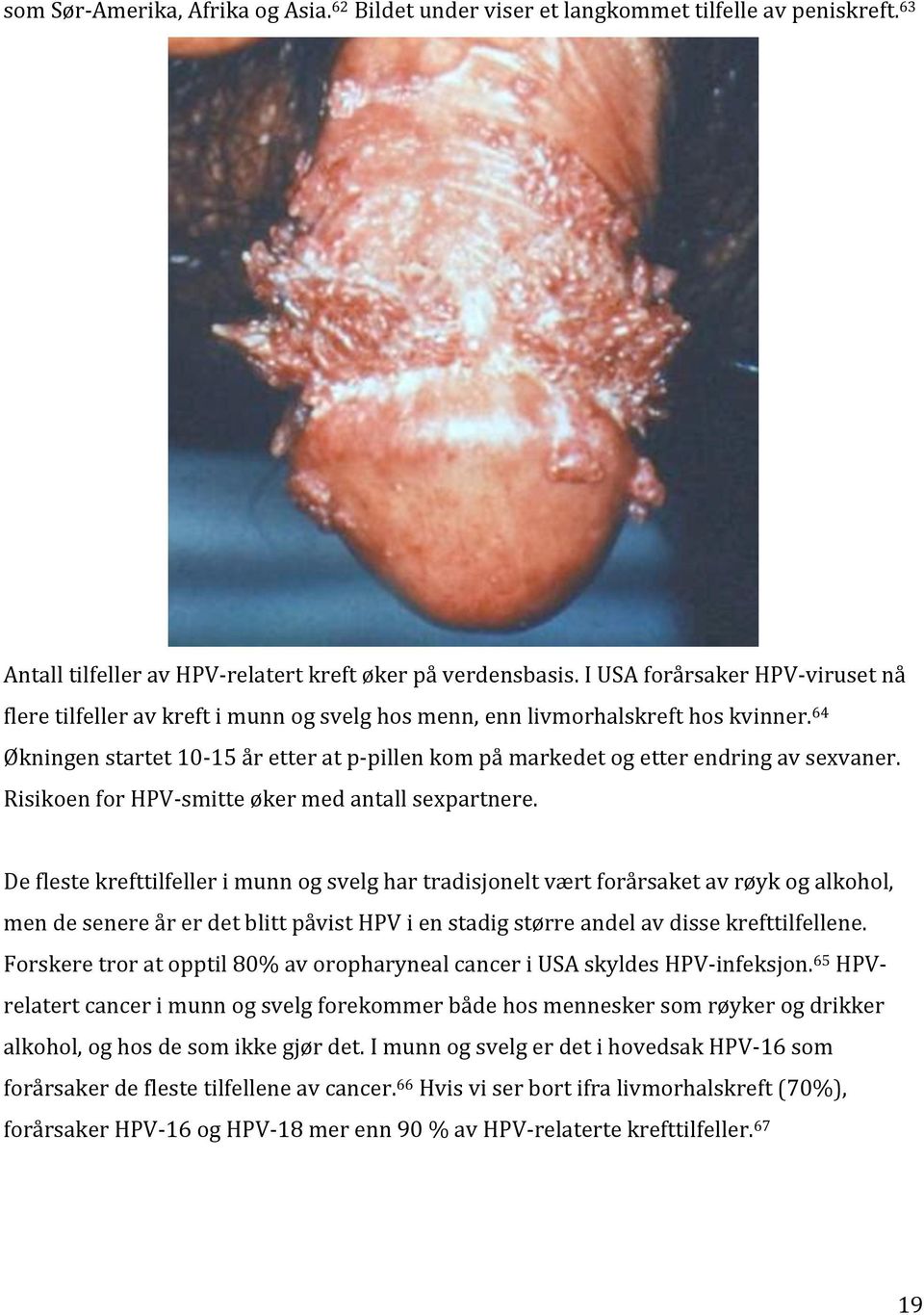 64 Økningen startet 10-15 år etter at p- pillen kom på markedet og etter endring av sexvaner. Risikoen for HPV- smitte øker med antall sexpartnere.