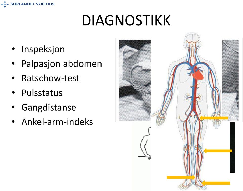 TÆR? SYMMETRISK? JEVNT? KLAUDIKASJON? REAKTIV HYPEREMI INNEN 5 SEK.? FOTSÅLE?