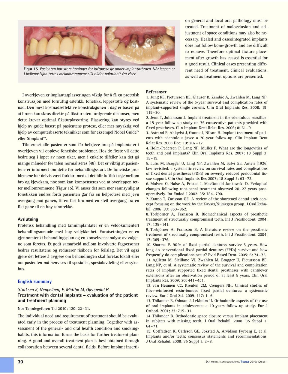 Together with assessment of the general- and oral health condition and smokinghabits, this information forms the basis for further treatment planning.