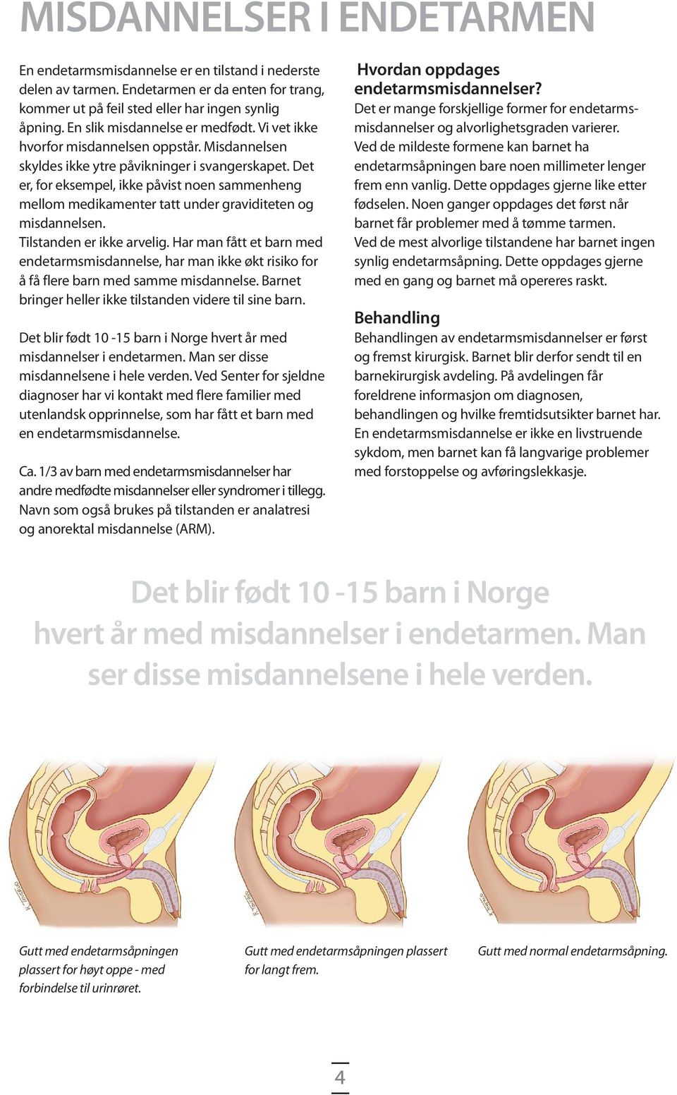 Det er, for eksempel, ikke påvist noen sammenheng mellom medikamenter tatt under graviditeten og misdannelsen. Tilstanden er ikke arvelig.