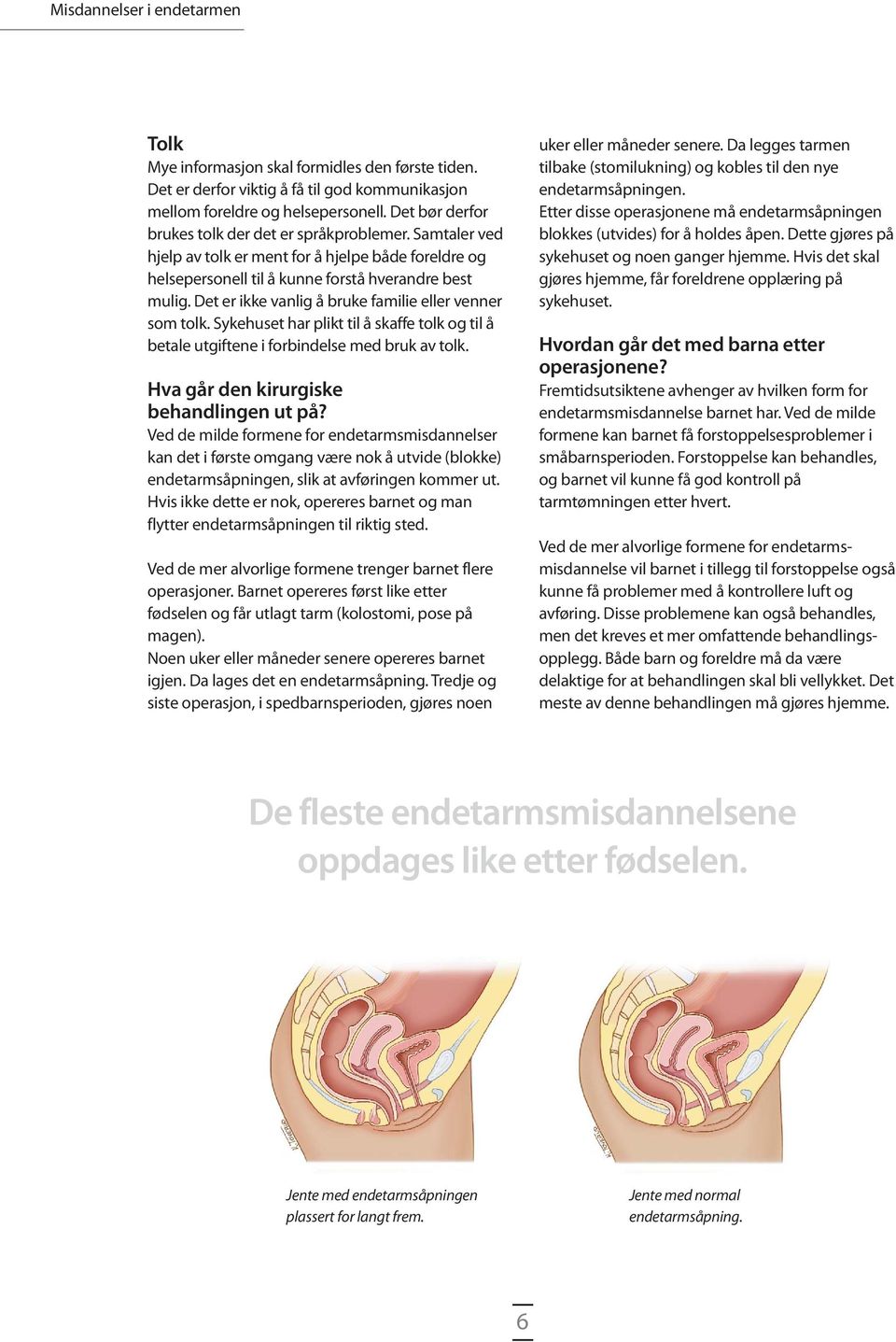 Det er ikke vanlig å bruke familie eller venner som tolk. Sykehuset har plikt til å skaffe tolk og til å betale utgiftene i forbindelse med bruk av tolk. Hva går den kirurgiske behandlingen ut på?