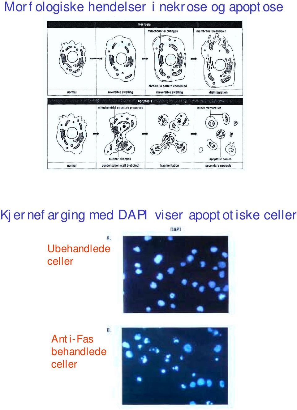 viser apoptotiske celler