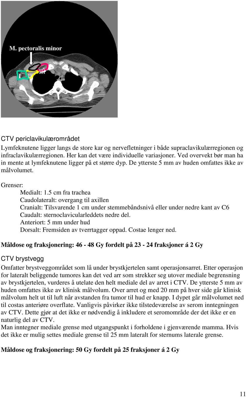5 cm fra trachea Caudolateralt: overgang til axillen Cranialt: Tilsvarende 1 cm under stemmebåndsnivå eller under nedre kant av C6 Caudalt: sternoclavicularleddets nedre del.