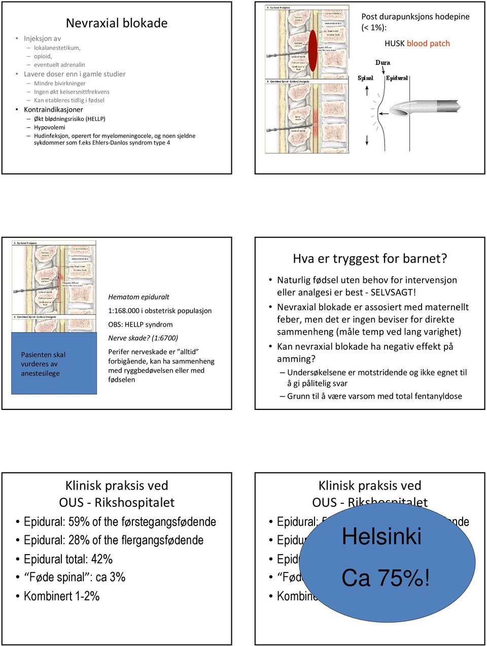 eksehlers-danlossyndrom type 4 Post durapunksjonshodepine (< 1%): HUSK blood patch Pasienten skal vurderes av anestesilege Hematom epiduralt 1:168.