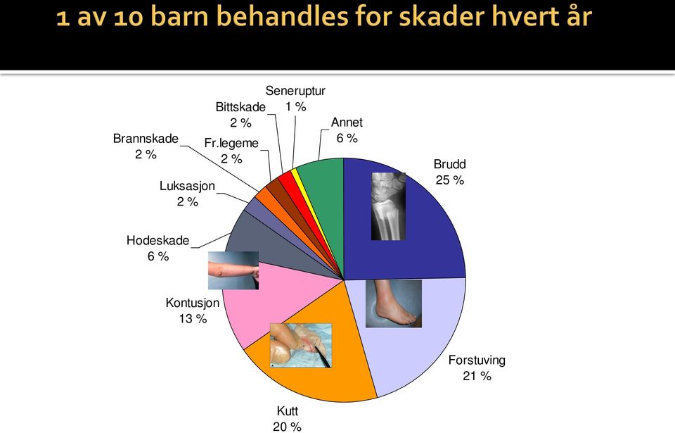 legeme 2 % Annet 6 % Brudd 25 %