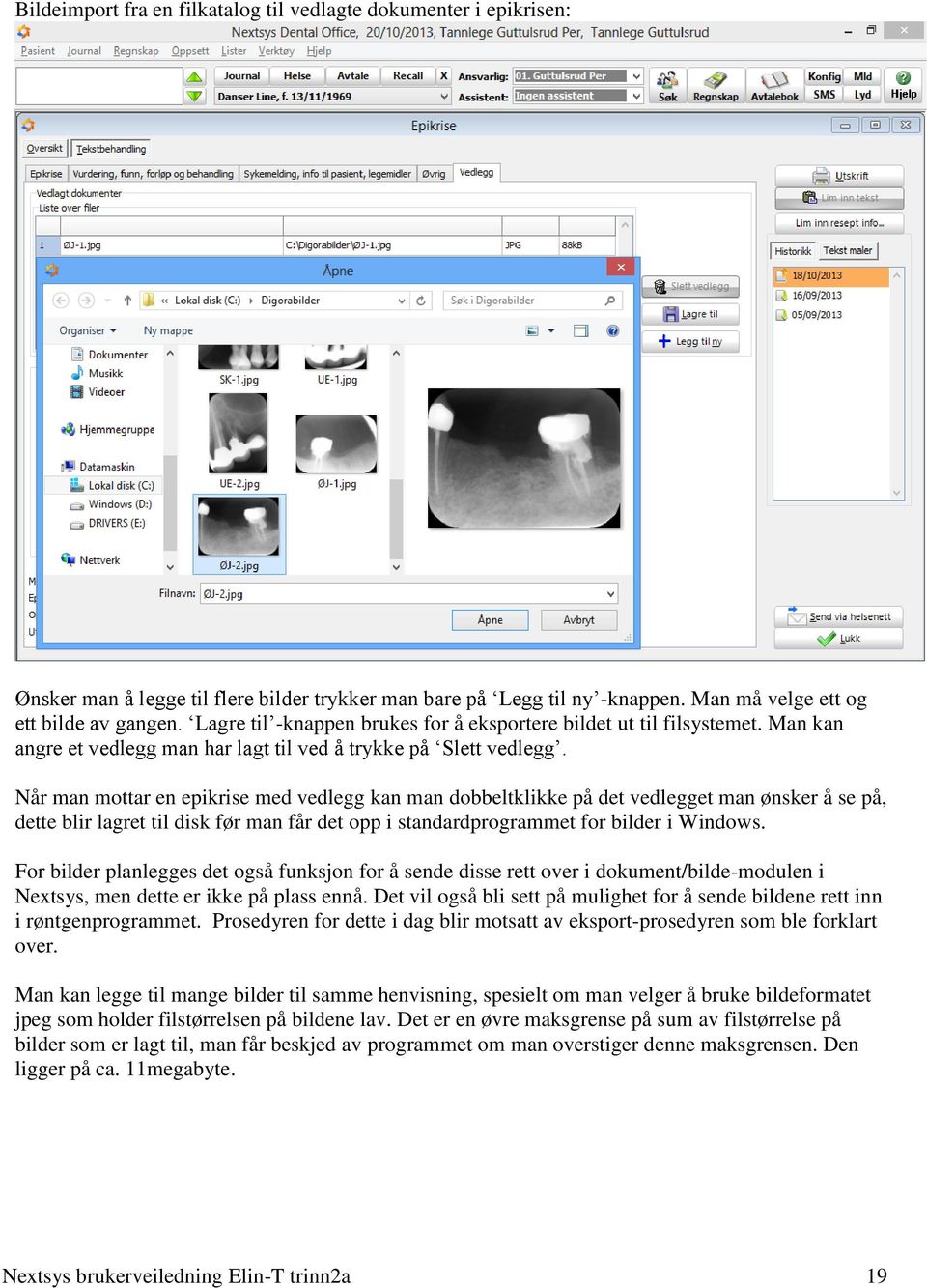 Når man mottar en epikrise med vedlegg kan man dobbeltklikke på det vedlegget man ønsker å se på, dette blir lagret til disk før man får det opp i standardprogrammet for bilder i Windows.