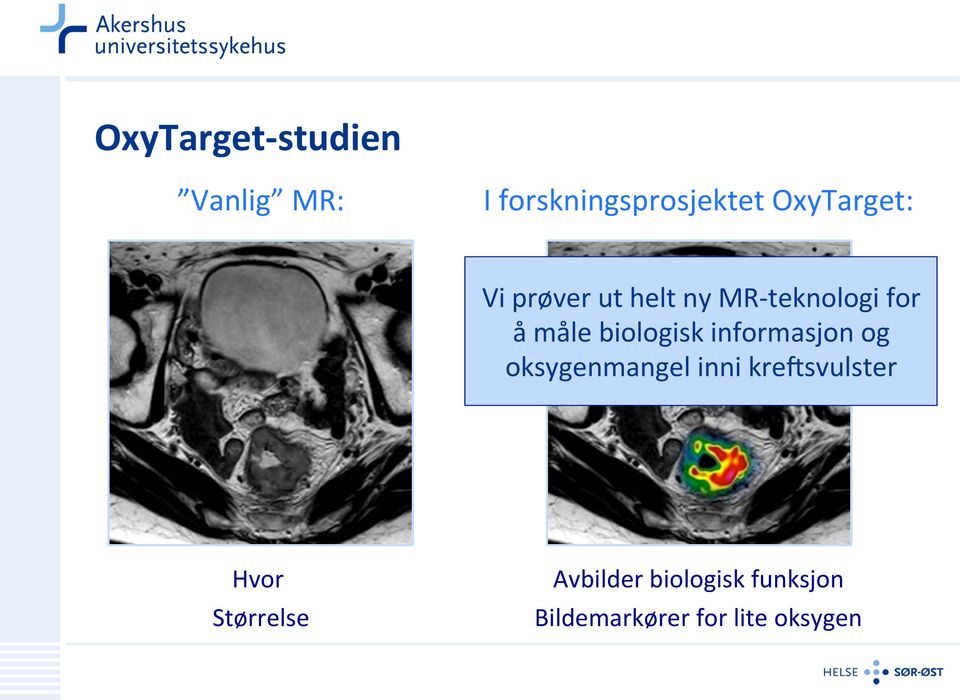 biologisk informasjon og oksygenmangel inni kre2svulster