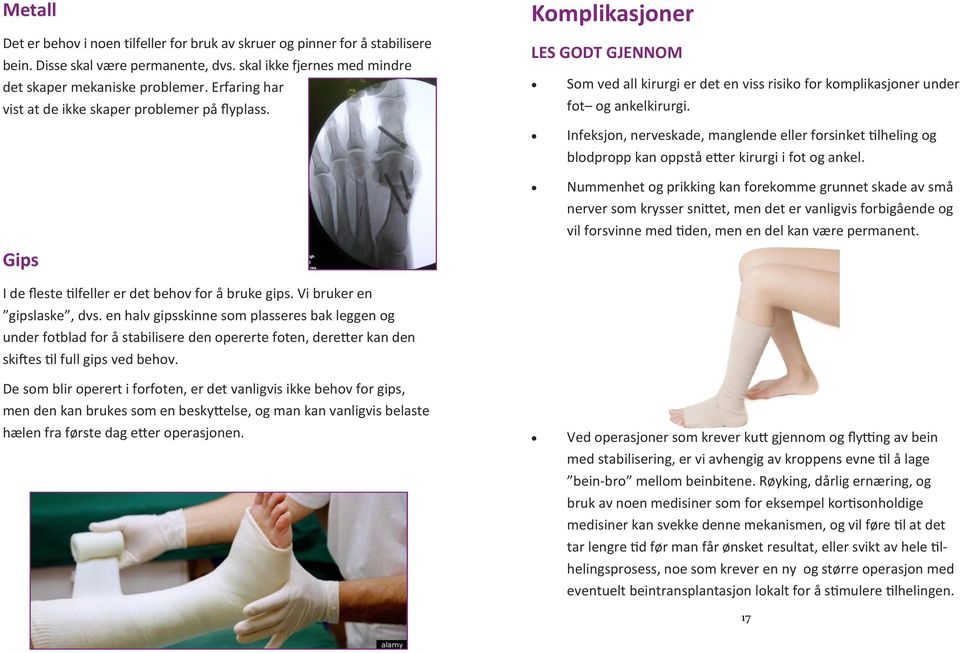 Gips I de fleste tilfeller er det behov for å bruke gips. Vi bruker en gipslaske, dvs.