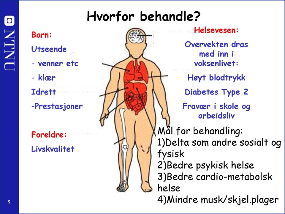 Helsevesen: Overvekten dras med inn i voksenlivet: Høyt blodtrykk Diabetes Type 2