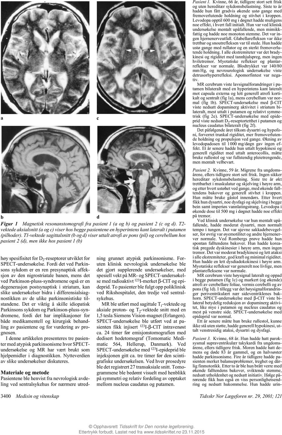 Fordi det ved Parkinsons sykdom er en ren presynaptisk affeksjon av den nigrostriatale banen, mens det ved Parkinson-pluss-syndromene også er en degenerasjon postsynaptisk i striatum, kan slike