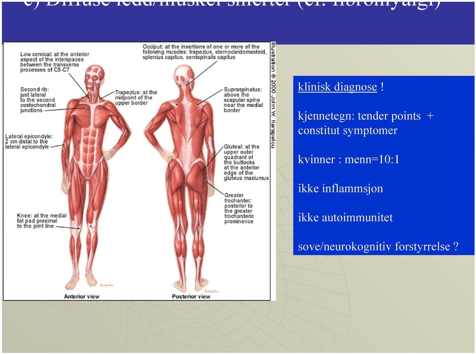 kjennetegn: tender points + constitut symptomer