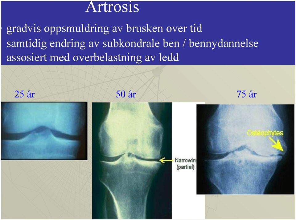 subkondrale ben / bennydannelse -