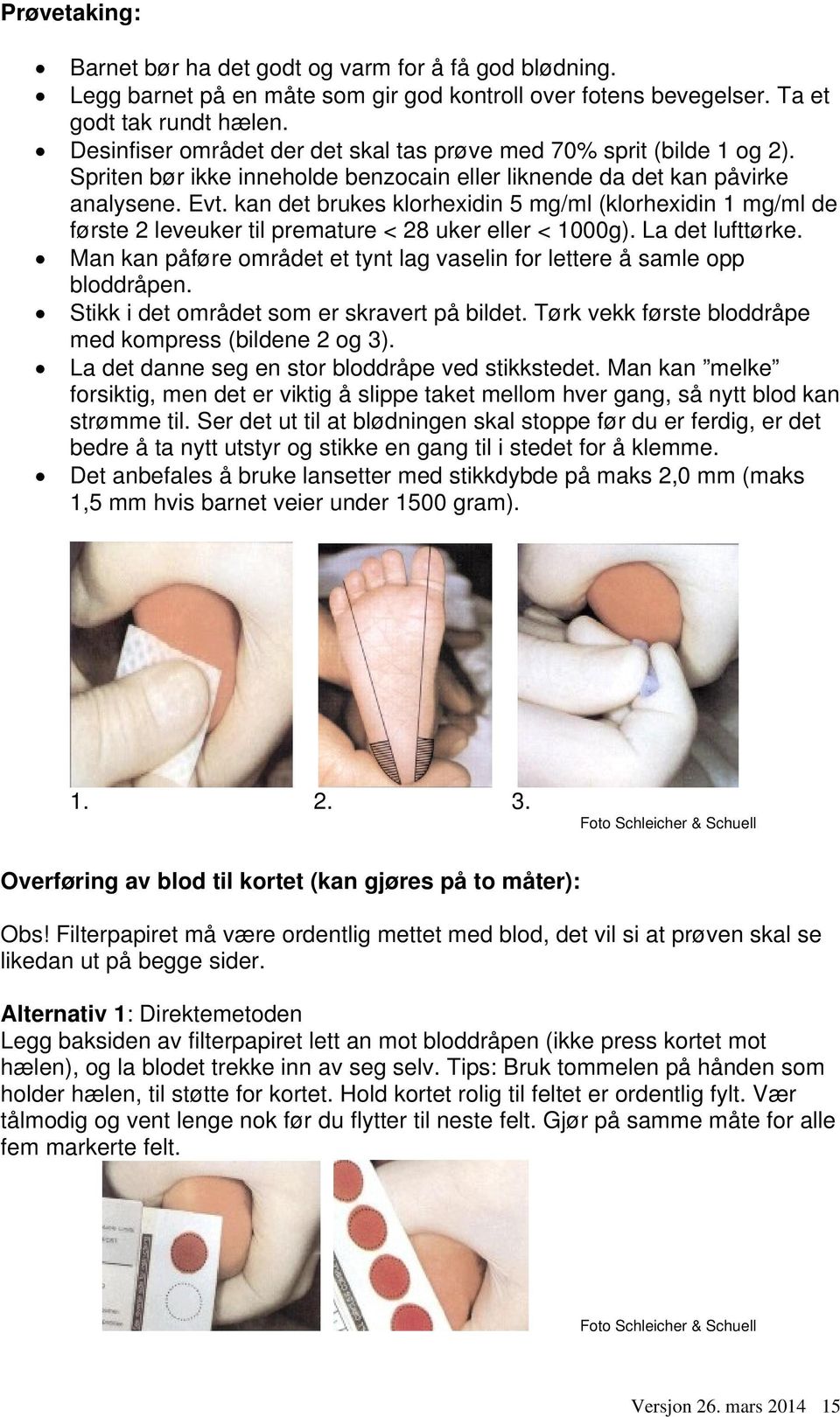 kan det brukes klorhexidin 5 mg/ml (klorhexidin 1 mg/ml de første 2 leveuker til premature < 28 uker eller < 1000g). La det lufttørke.