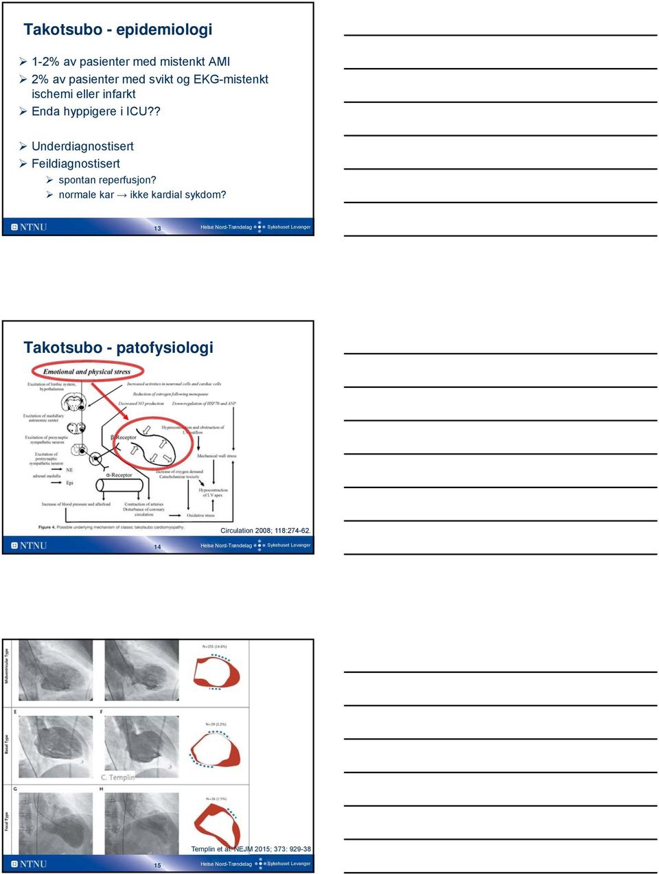 ? Underdiagnostisert Feildiagnostisert spontan reperfusjon?