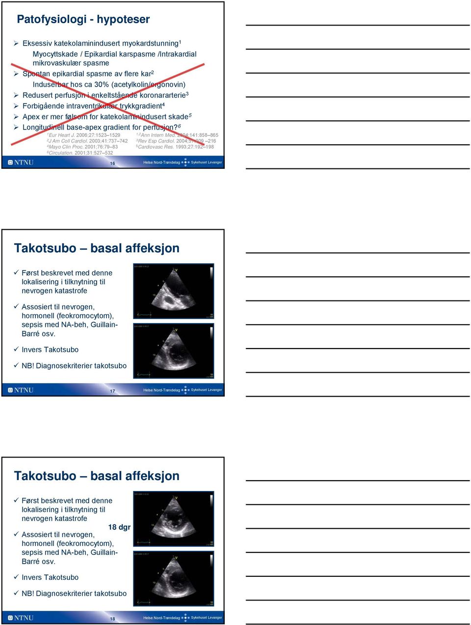 base-apex gradient for perfusjon? 6 1 Eur Heart J. 2006;27:1523 1529 1,2 Ann Intern Med. 2004;141:858 865 2 J Am Coll Cardiol. 2003;41:737 742 3 Rev Esp Cardiol. 2004;57:209 216 4 Mayo Clin Proc.