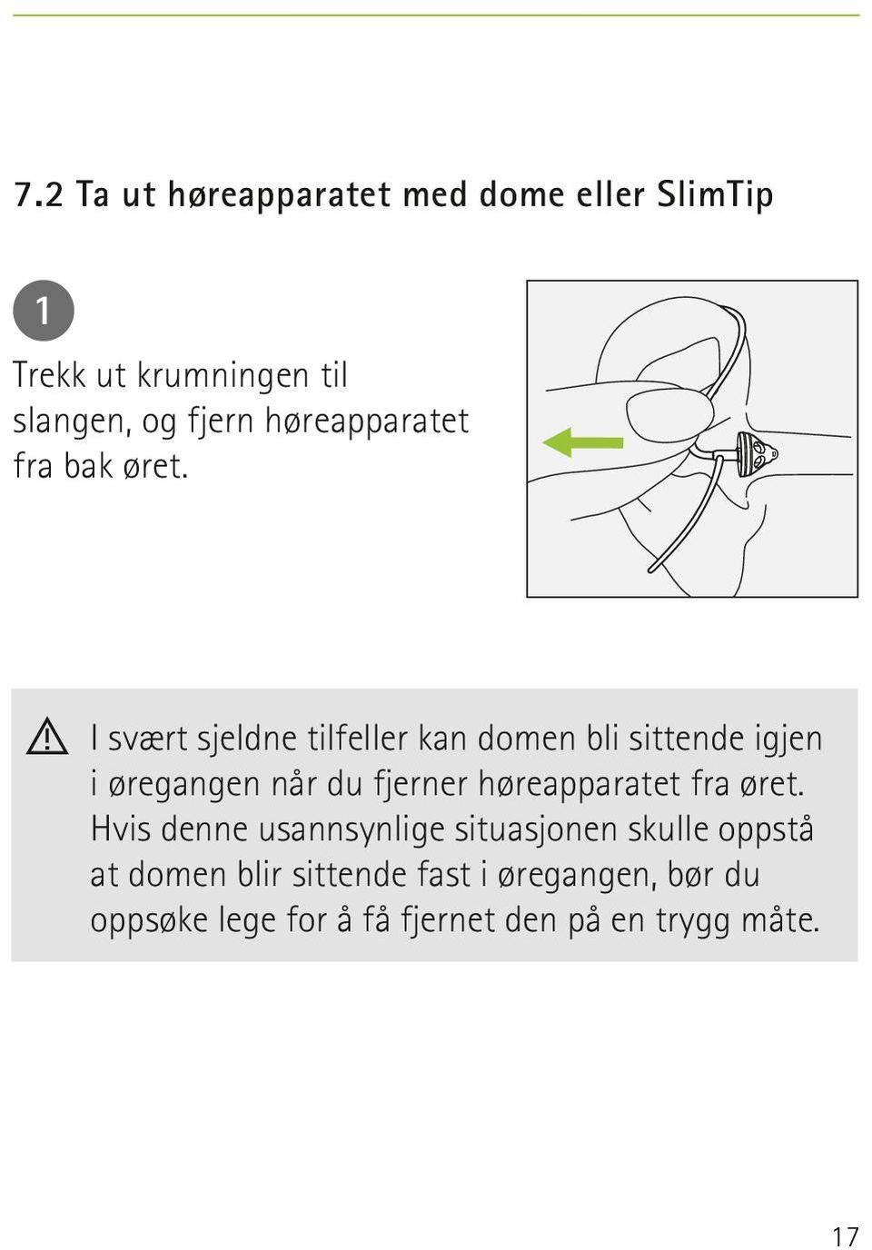 I svært sjeldne tilfeller kan domen bli sittende igjen i øregangen når du fjerner