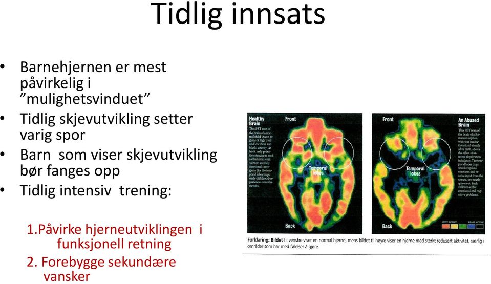 som viser skjevutvikling bør fanges opp Tidlig intensiv