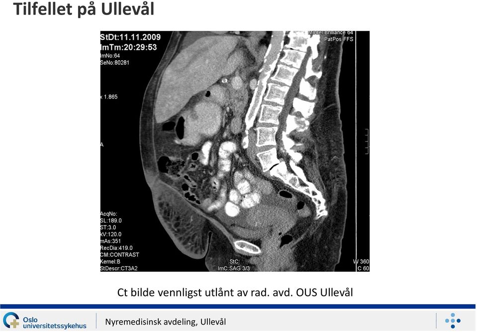 vennligst utlånt