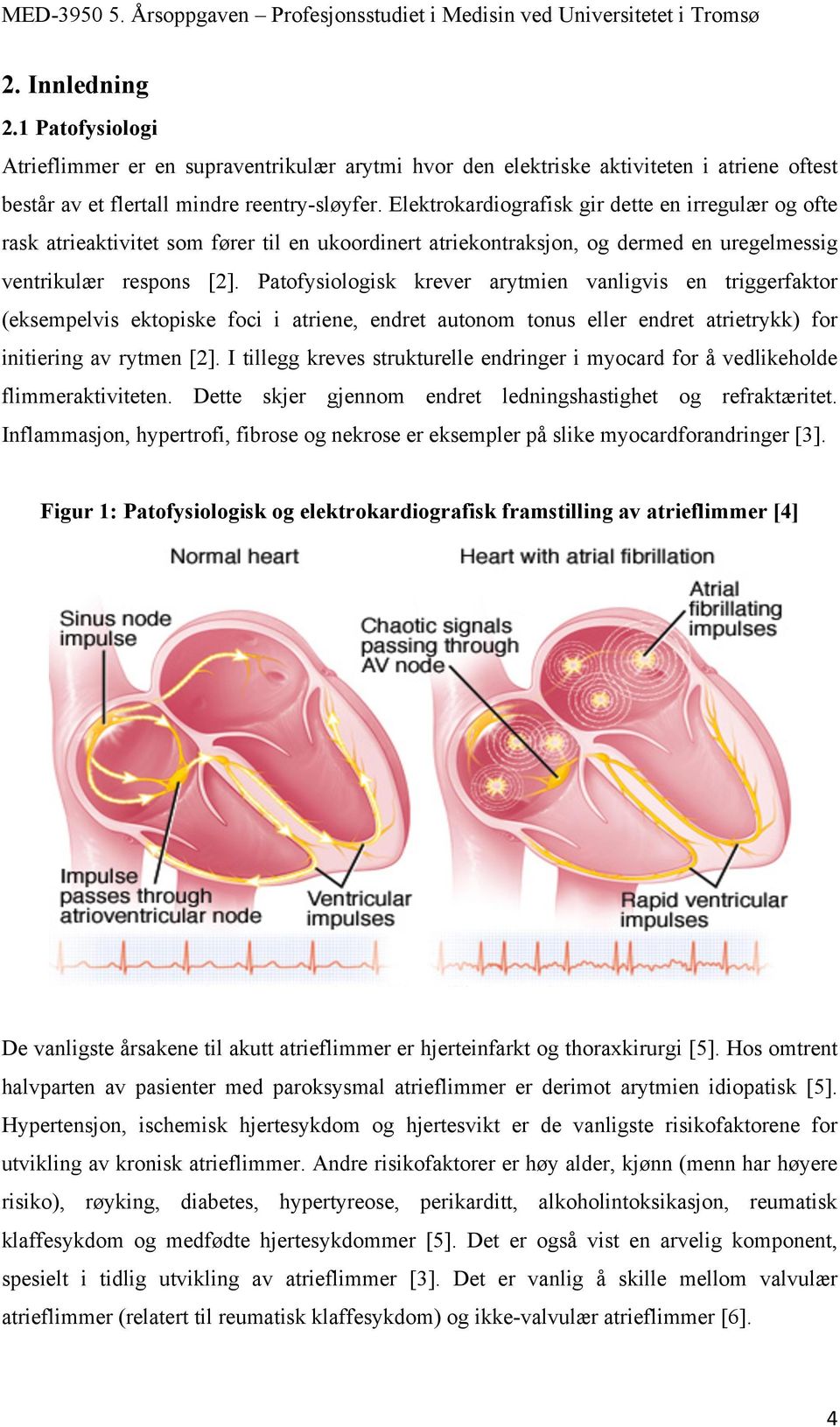 Patofysiologisk krever arytmien vanligvis en triggerfaktor (eksempelvis ektopiske foci i atriene, endret autonom tonus eller endret atrietrykk) for initiering av rytmen [2].