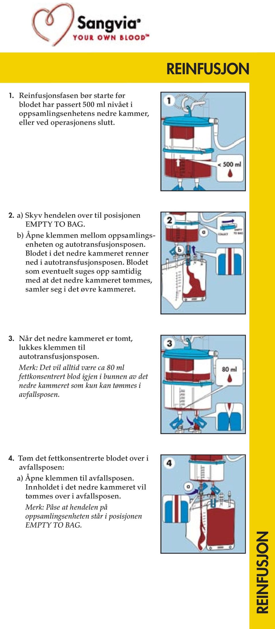 Blodet som eventuelt suges opp samtidig med at det nedre kammeret tømmes, samler seg i det øvre kammeret. 3. Når det nedre kammeret er tomt, lukkes klemmen til autotransfusjonsposen.