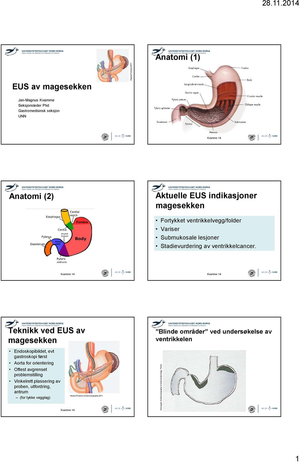 Teknikk ved EUS av magesekken Blinde områder ved undersøkelse av ventrikkelen Endoskopibildet, evt gastroskopi først Aorta for orientering