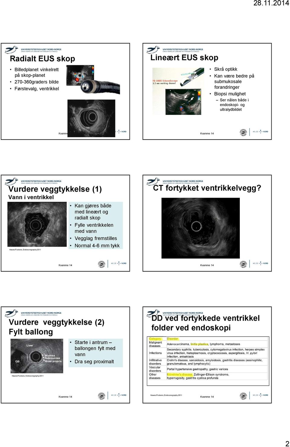 Kan gjøres både med lineært og radialt skop Fylle ventrikkelen med vann Vegglag fremstilles Normal 4-6 mm tykk CT fortykket ventrikkelvegg?